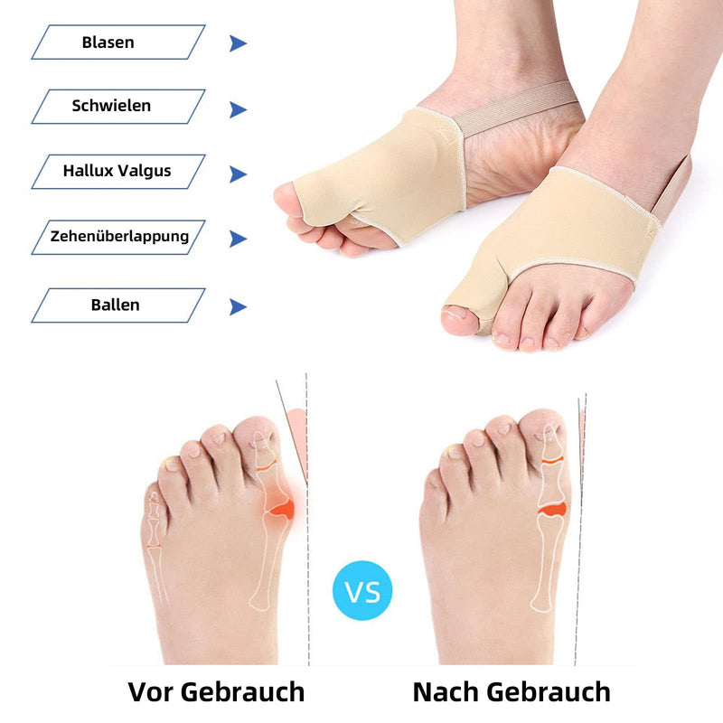 Eurtes Pack of 6 Hallux Valgus Toe Separators with Bunion Protection, Correction Bandage Socks Bunion Corrector with Anti-Slip Belt and Gel Pads for Valgus Bunion (Pack of 6) - NewNest Australia