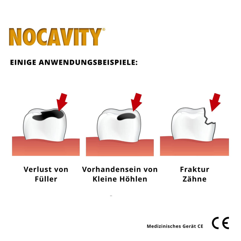 Nocavity - Temporary Dental Filling Set - Isolates the tooth cavity and relieves pain from filling loss, small caures and broken teeth - NewNest Australia
