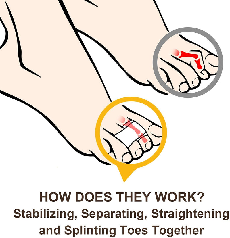 6Pcs Hammer Toe Straightener, Hammer Toe Splints, Toe Cushioned Bandages for Correcting Hammer Toes, Crooked Toes & Overlapping Toes，Protecting Curved Toes and Hammertoes, Overlapping Toe Protector - NewNest Australia