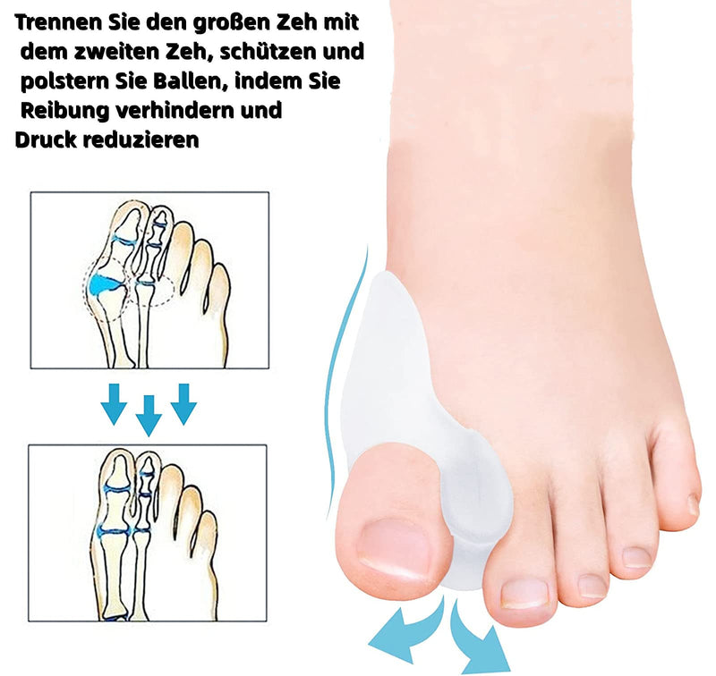 Gel Large Toe Separator Bunion Protector Pain Relief For Crooked Hallux Valgus Overlapping Toes Pressure Protection Corrector Shield Pad Separator Cushion 6 Pack - NewNest Australia