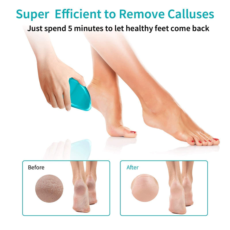 Foot File, Nano Glass Hard Skin Callus Remover, Foot Scraper Salon Home Pedicure Tool for Foot Beauty Care, Can Be Used on Both Wet/Dry Cracked Feet, Foot Rasp by AnjoCare Blue - NewNest Australia