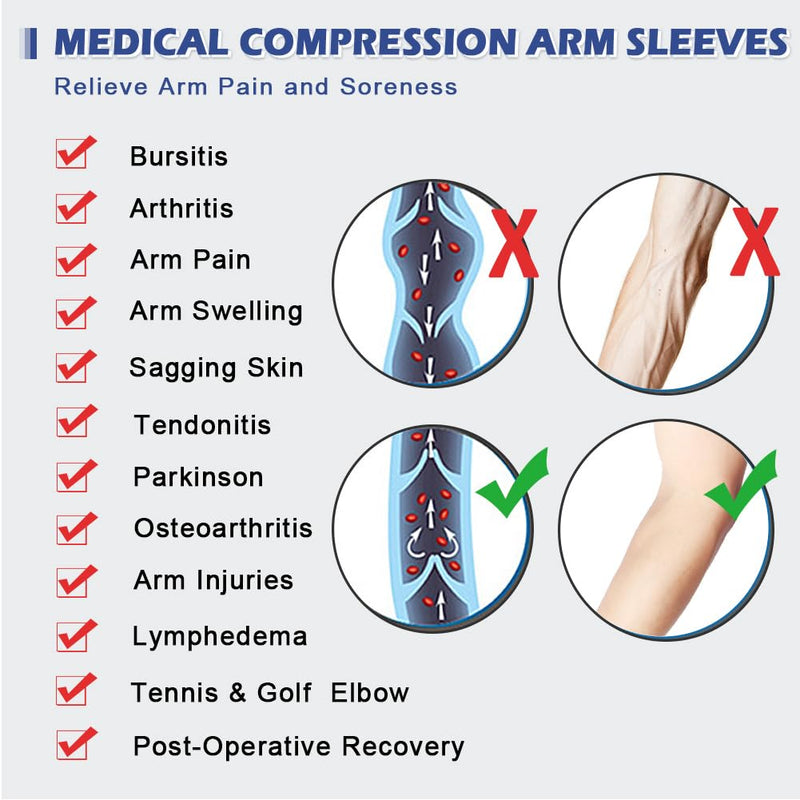 Beister Medical Compression Arm Bandage Supports: 20-30 Mmhg Arm Sleeves For Men & Women (Pair), Arm Protection, Elbow Brace, Compression Sleeves For Arthritis, Tennis Elbow, Lymphedema - NewNest Australia