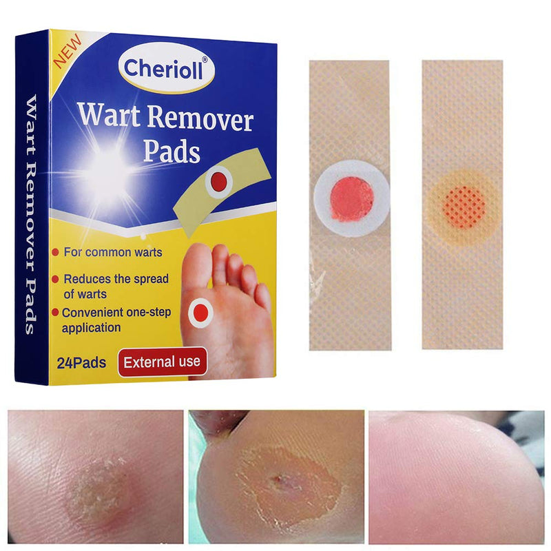 Wart Remover, Wart Removal Plasters Pad, Foot Corn Removal Plaster with Hole, Feet Callus Remove, Soften Skin Cutin Sticker Cure Toe Protector, Relief Pain Removal Warts Plaster 24 Pcs/Box - NewNest Australia