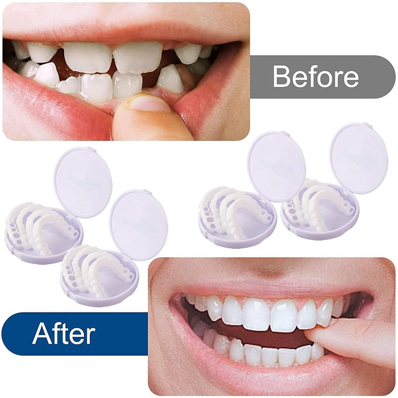 Comioke Prostheses Fake Teeth, 4 Pairs False Artificial Teeth Braces Smile Veneers Cosmetic Temporary Teeth Dentures Prosthesis Artificial Veneers Teeth Top and Bottom 4color - NewNest Australia