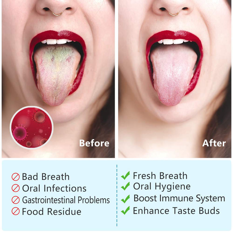 Tongue Scraper,Morgles 4Pcs Tongue Scrapers for Adults Kids Medical Grade Metal Tongue Scraper Cleaner with Case Great for Oral Hygiene Reduce Bad Breath - NewNest Australia