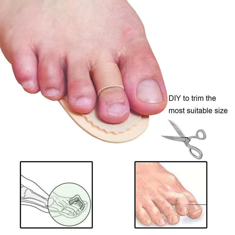 Mcvcoyh Adjustable 2 Loops Toe Splint, Hammer Toe Straightener with Cushion for Toe Claw, Curled & Crooked Toes - Support Guard Protector for Pre Post Surgery Broken Overlapping Toes 1 Pair - NewNest Australia