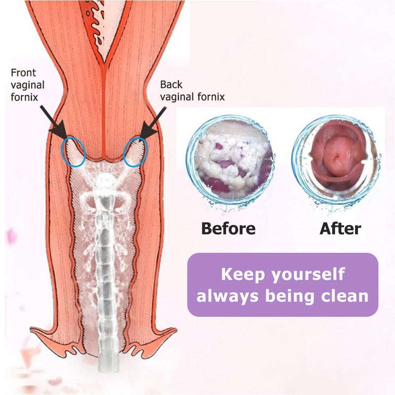 Reusable Vaginal Cleansing System, 300ml Vaginal Cleanser Vaginal Douche for Women, Anal Douche Manual Pressure Enemas for Douche Vagina Cleaning Kit with 3 Nozzle Tips, Suitable for Men and Women - NewNest Australia