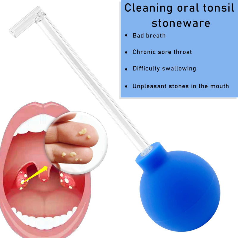 Lets Joy Tonsil Stone Remover for Removing Tonsil Stones, Tonsil Stone Cupping Glass, Tonsil Stone Removal, Tonsil Sucker Tonsil Stone, Tonsil Stone Remove Tools, Fresh Breath Oral Care Blue - NewNest Australia