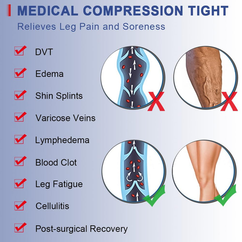 beister Medical compression stockings for women, long, 20-30 mmHg, support stockings for men, opaque toe-free compression trousers, class 2, solid support for varicose veins, edema, black L - NewNest Australia