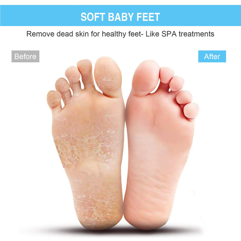 HONYIN Larger Shower Foot Scrubber, Foot Cleaner Massager Mat with Non-Slip Suction Cups - Cleans, Exfoliation, Massages Your Feet Without Bending, Foot Circulation & Relieve Tired Feet Gray - NewNest Australia