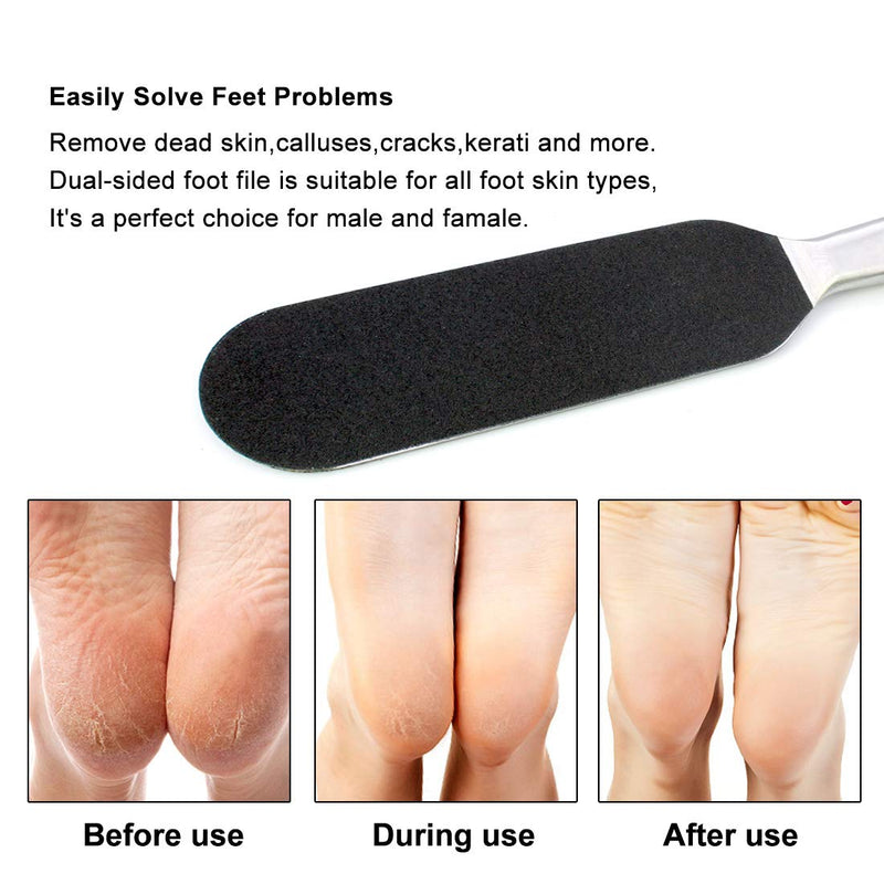 Pedicure Foot File Callus Remover for Dead Skin,Stainless Steel Foot Rasp Scrubber with 10pcs Free Refill Grits Replacement Pads - NewNest Australia