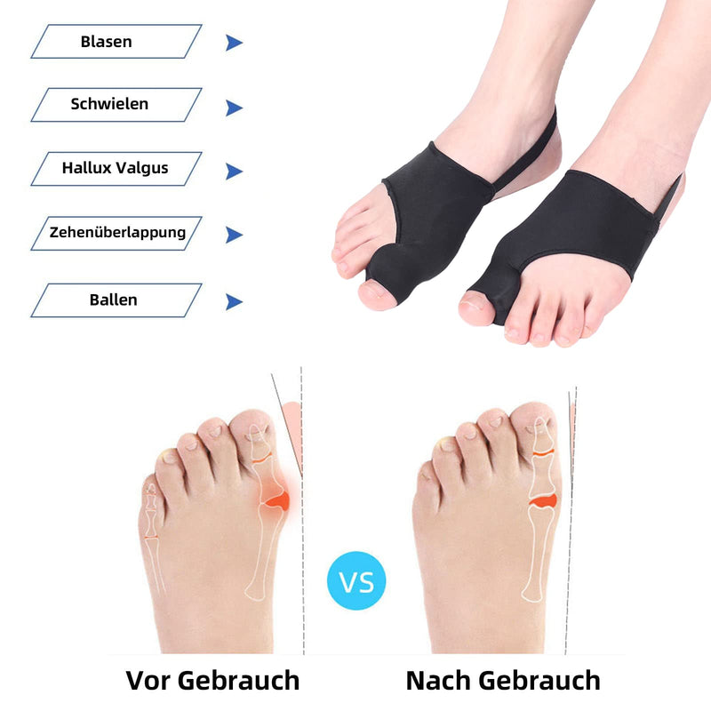 Eures Pack of 6 Hallux Valgus Toe Separators with Bunion Protection, Correction Bandage Socks Bunion Corrector with Anti-Slip Belt and Gel Pads (Black) Pack of 6 Black - NewNest Australia
