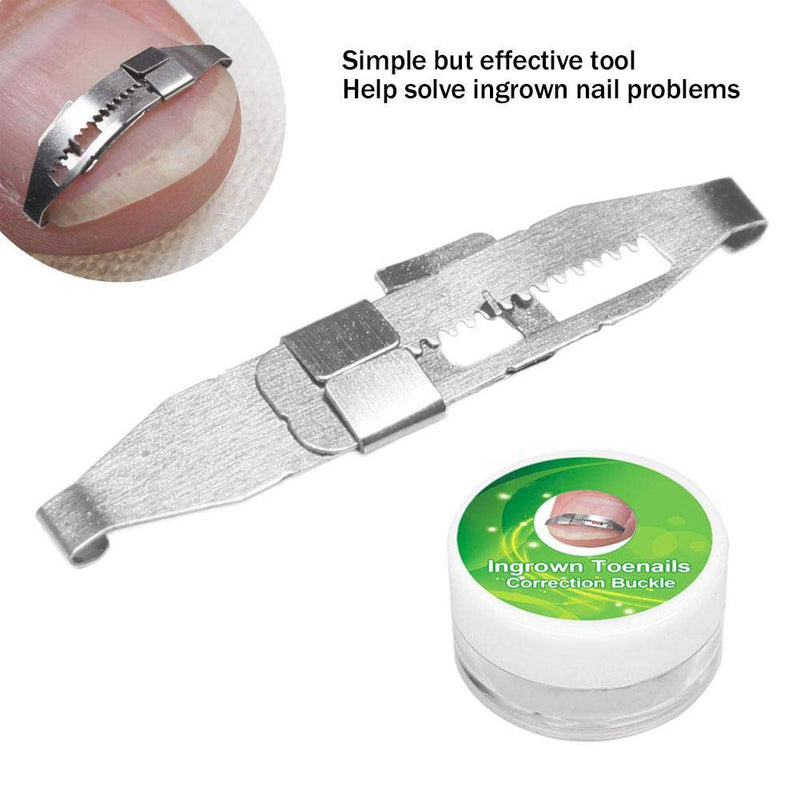 3pcs Ingrown Toenail Tools, Stainless Steel Ingrown Toenail Corrector Pain Relief Paronychia Treatment Correcting Tool for Ingrown Toe Nails Curve Correct, Correct Toes - NewNest Australia