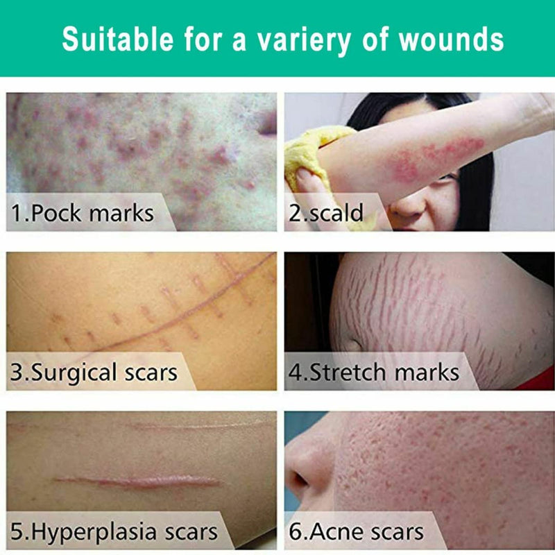 Scar Removal Cream New & Appearance of Old Scars Surgery, Stretch Marks, Acne, Burns & Injuries Face or Body, Working for Removing Scars and Strech Mark for Pregnancy - NewNest Australia