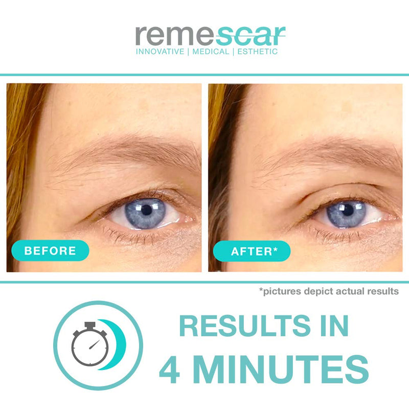 Remescar - Sagging Eyelids - Eye Lift Cream for Puffiness - Clinically Proven Anti-Ageing Eye Cream for Men and Women - NewNest Australia