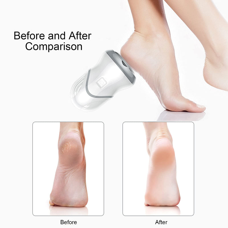 Senkora Foot File Electric Pedicure Callus Remover Hard Skin Foot Care Tools Vacuum Adsorption Professional Feet Machine for Dead Dry Skin and Cracked Heels USB Rechargeable for Women Gift - NewNest Australia