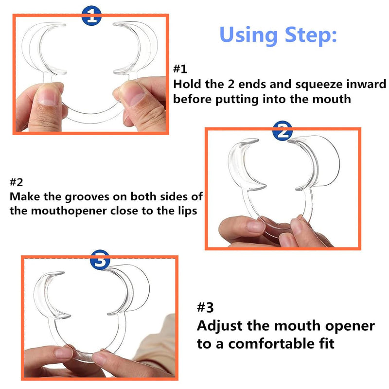 Dental Cheek Retractor, 12 Pcs C Shape Autoclavable Mouth Opener for Teeth Whitening, 3 Sizes Clear Lip Cheek Retractor for Dentist Party Mouth Guard Speak Out Challenge Game - NewNest Australia