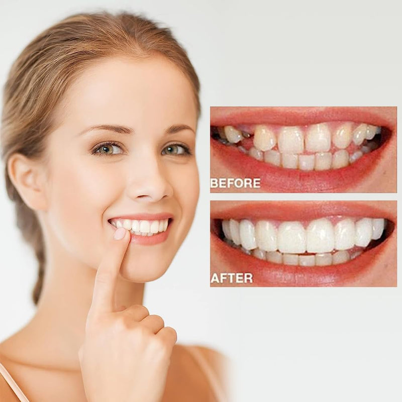 Comioke Prostheses Fake Teeth, 4 Pairs False Artificial Teeth Braces Smile Veneers Cosmetic Temporary Teeth Dentures Prosthesis Artificial Veneers Teeth Top and Bottom 4color - NewNest Australia