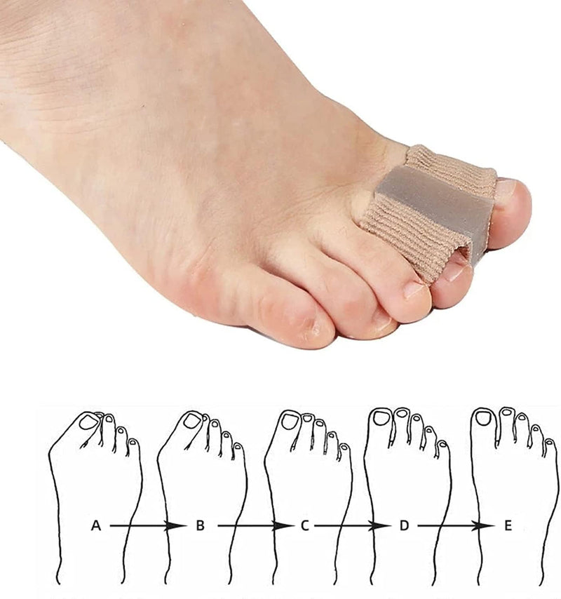 Pack of 2 toe separators bunion for hallux valgus correction with 2 foot straps, gel toe spacer for bunion pain and overlapping toes hammer toe - NewNest Australia