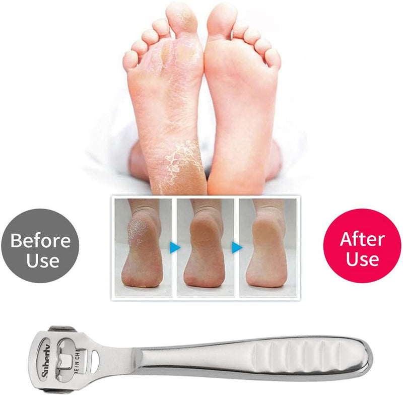 Foot Scraper, SONGQEE Hard Skin Callus Remover Foot Shaver Foot File Pedicure Feet Care Set with 10pcs Blade, Foot File Head, Dead Skin Fork, Toenails Lifter and Storage Case - NewNest Australia