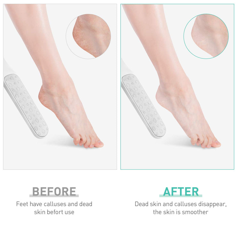 Foot File Double-Sided Hard Dead Skin Remover Stainless Steel Foot File Rasp Heel Peel Foot Scrubber Feet Pedicure Callus Remover for Wet and Dry Cracked Feet White - NewNest Australia