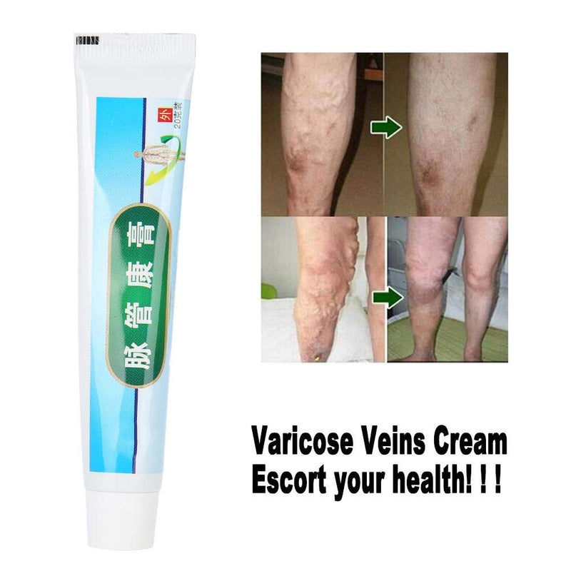 Varicose veins leg cream, anti phlebitis vein care The appearance of Kang foot spider veins with organic ingredients external ointment - NewNest Australia