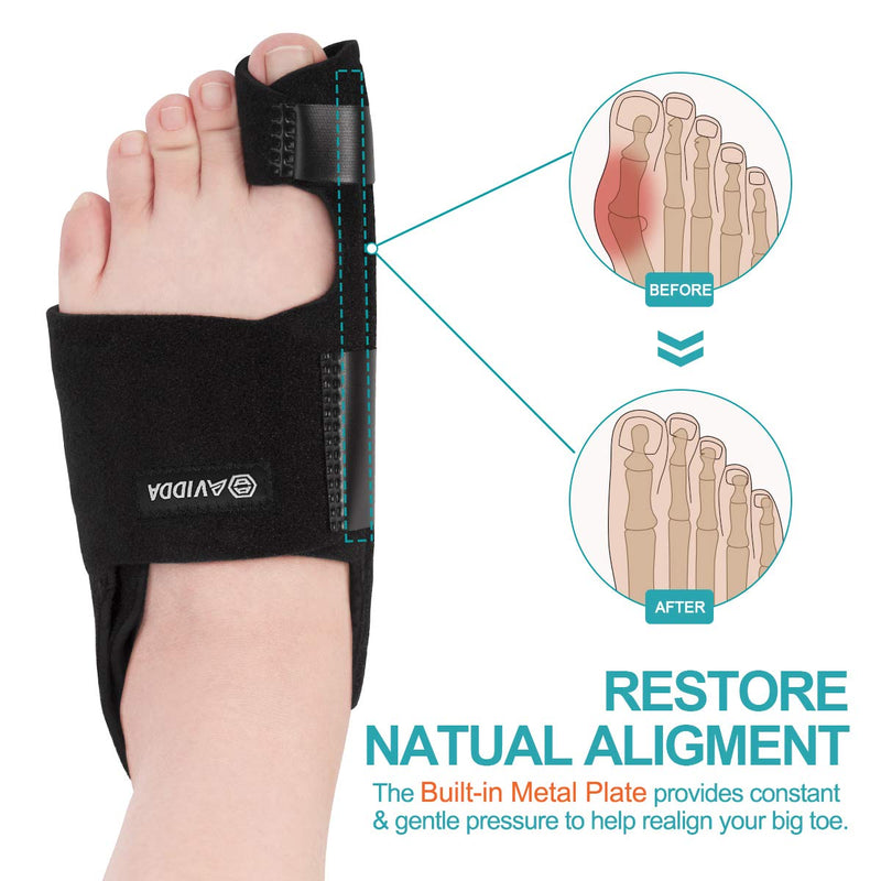 AVIDDA Bunion Corrector - 1 Pair Adjustable Bunion Splints and 2 Pack Gel Toe Separators, Toe Straighteners for Bunion Pain Relief, Overlapping Toes, Hallux Valgus, Crooked Toes (Black) Black 1 Pair-upgraded - NewNest Australia