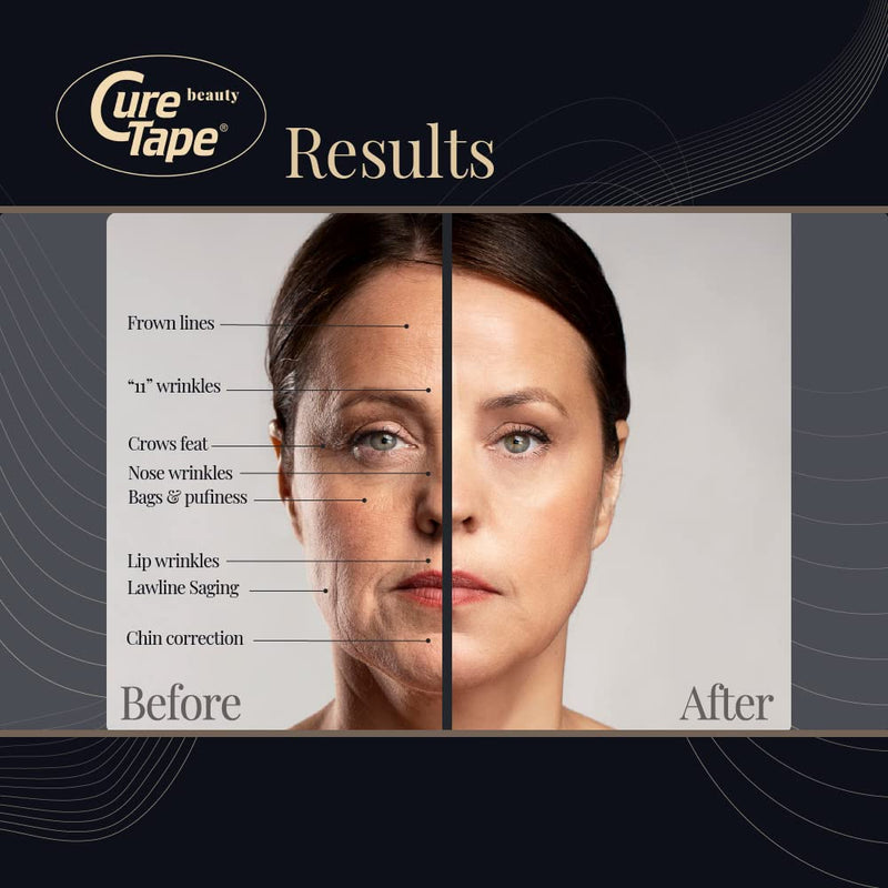 CureTape® Beauty Kinesiology Tape (5cm x 5 m) | Beauty tape for face | Face Lift Tape | Facial tape for sensitive skin | Medically Approved | Soft on the skin - NewNest Australia