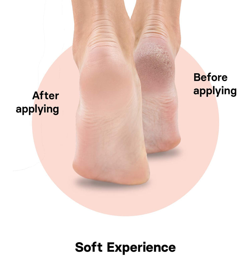 Valneo Hard Skin Remover Foot File for Men & Women - Foot Scraper with Natural Rubber & Wood Handle - Dead Skin & Callus Remover for Soft and Delicate Feet Rubber Wood - NewNest Australia