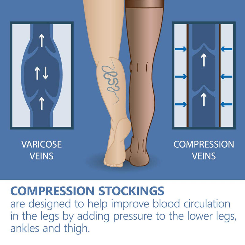 Medical Compression Stockings (23-32 Mmhg, Class 2) For Women And Men, Prevention Of Dvt, Varicose Veins And Spider Veins, Reduces Swelling, Thrombosis, Beige, Small - NewNest Australia