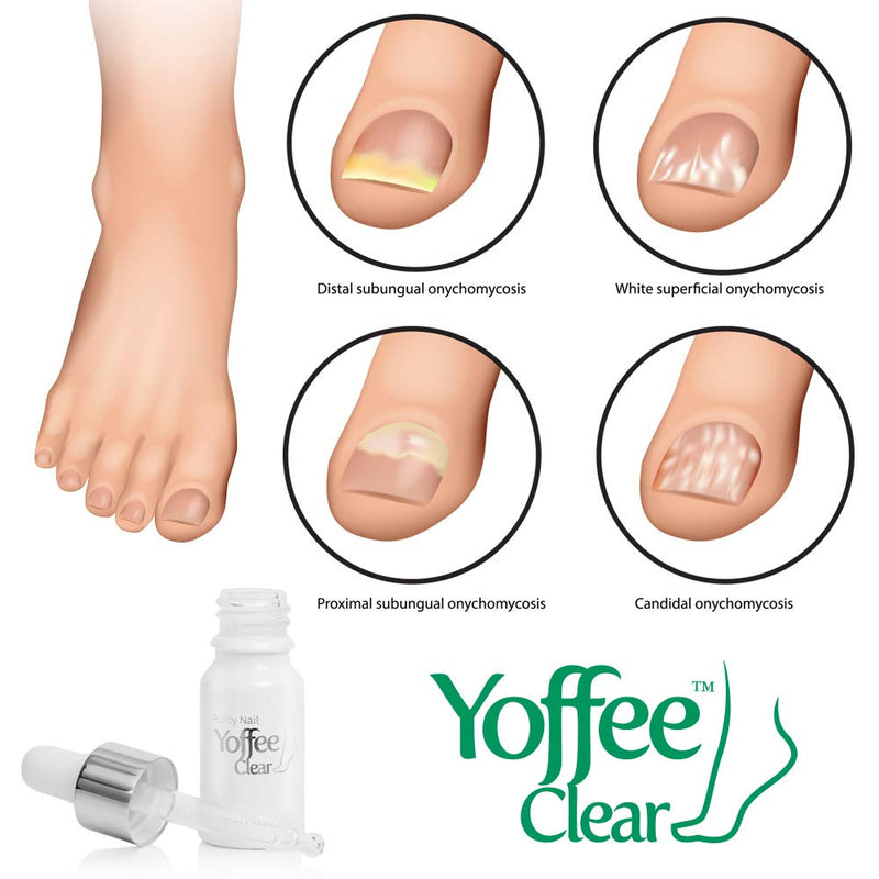 Yoffee Clear Nail Care - Anti Fungal Nail Treatment for Finger and Toenails - 10 ml - Antibacterial and Antiseptic - Fungal with Organic Argan Oil and Tea Tree Oil - Concentrated Formula/Made in Spain 10 ml (Pack of 1) - NewNest Australia