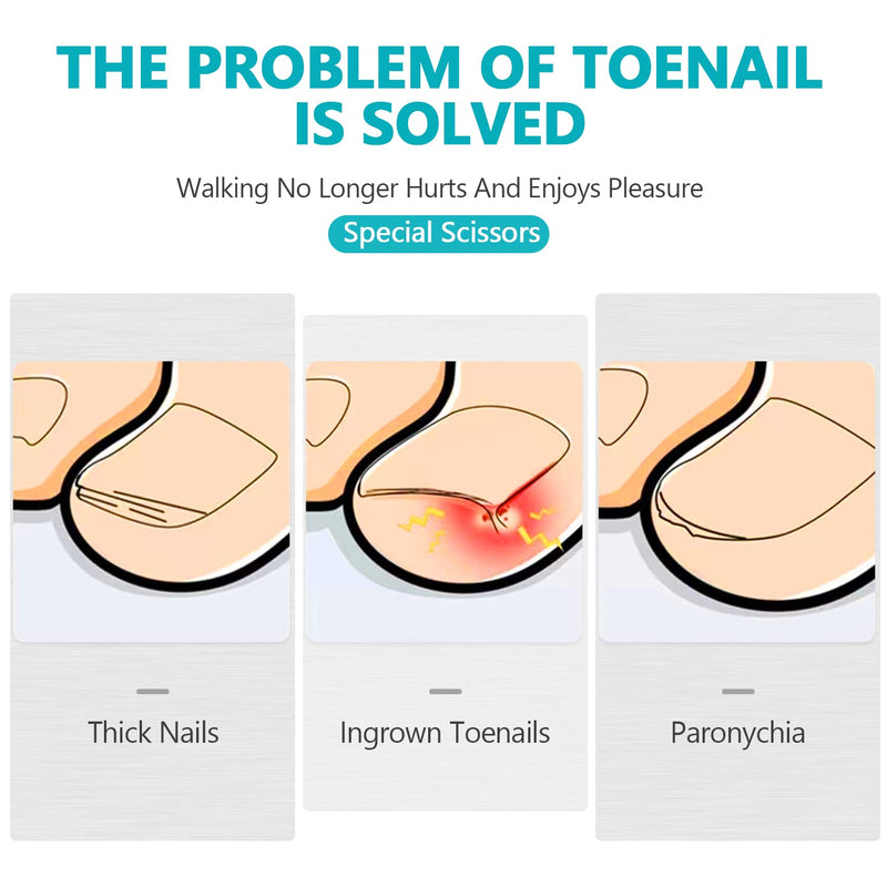 Toenail Clippers for Thick Nails - Nail Clippers Set for Men.Heavy Duty Professional Thick & Ingrown Toe Nail Clipper, Large Toenail Scissors for Elderly/Mens/Women,Long Handle Safety RONAVO(Black) Thick Nails KIT(Black) - NewNest Australia