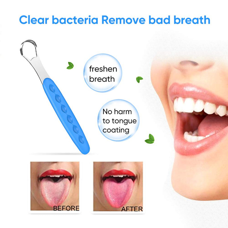 New Version Tongue Scraper Cleaner for Adults & Kids, Medical Grade Metal Tongue Brushes Set for Fresh Breath Dental Eliminate Bad Breath in Seconds (2 pcs) 2 Count (Pack of 1) Blue&Green Case - NewNest Australia