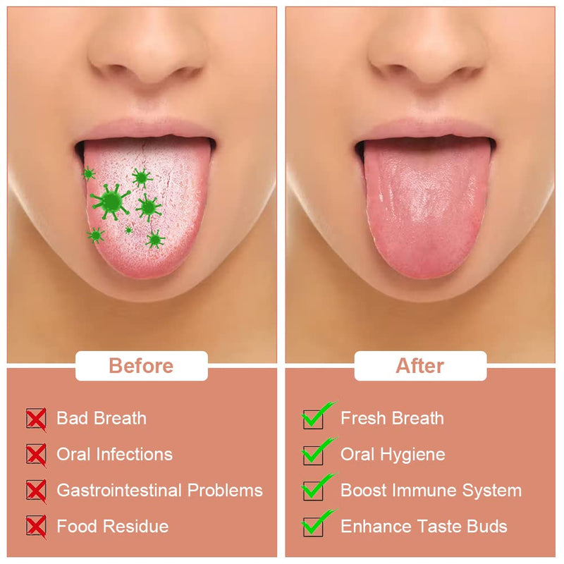 Acwoo Tongue Cleaner Stainless Steel, Pack Of 2 Tongue Scrapers, Toungescraper With Handles For Adults Oral Care, Tongue Scraper Probadent Against Bad Breath Tongue Brush Heals Bad Breath (Silver) Silver - NewNest Australia