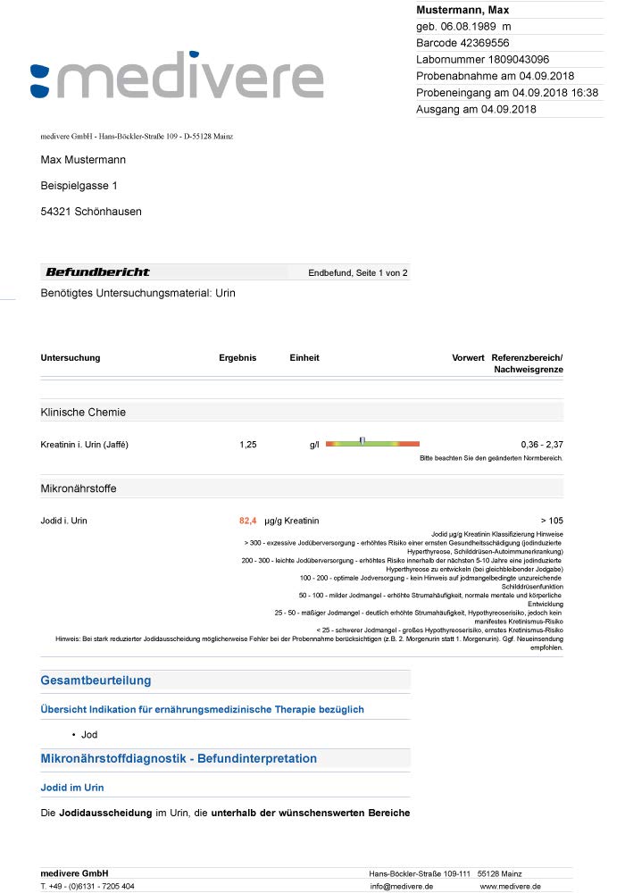 Iodide (iodine) urine test medivere - NewNest Australia