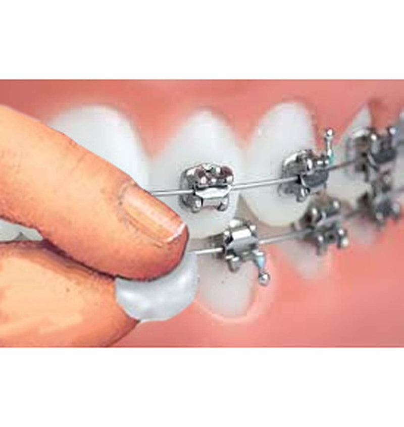 Genuine Orthowax - Orthodontic Wax for Braces Wearer - Stick Better Than competitors 9 - NewNest Australia