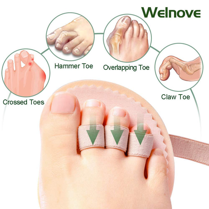 Welnove Toe Separator, Hammer Toe Correctors, Hammer Toe Foot Pad, for Hammer Toe, Claw Toe Correctors - Pack of 2 (3 Holes) - NewNest Australia