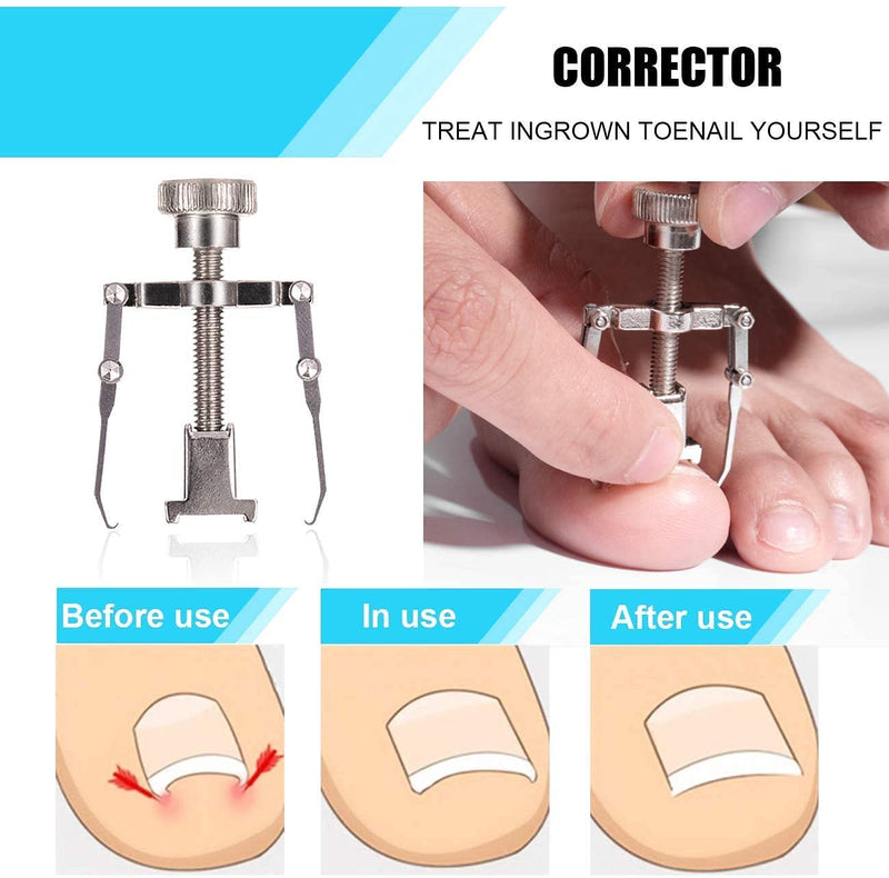 Toenail Clippers Set 7Pcs, Staineless Steel Ingrown Toenail Tool Kit, Professional Toe Nail Nippers Set for Ingrown & Thick Nail, Surgery Grade Manicure Pedicure Tool By OosoFitt Silver - NewNest Australia