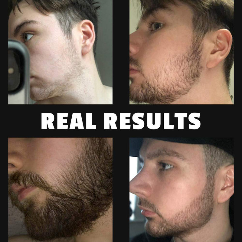 Red-Blooded Beard Growth Kit - Beard Roller + Beard Oil + Beard Balm - Stimulate Beard and Hair Growth Scented Beard Care Gift for Men - 0.5mm Dermaroller for Hair, Beard Regrowth - NewNest Australia