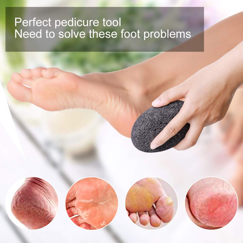 Natural Pumice Stones for Feet, Premium Exfoliator & Foot File,Foot File Callus Remover Foot Cracked Heels,Dead Skin,Hard Skin (Black) Black - NewNest Australia