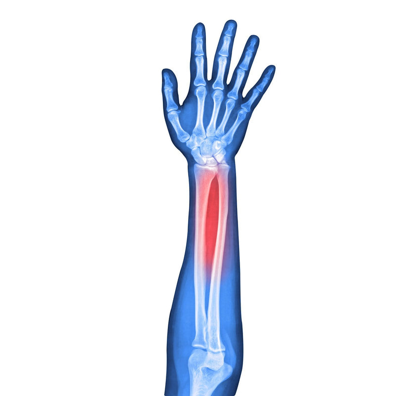 Soles SLS510L Wrist Splint with Thumb Stabilizer - NewNest Australia