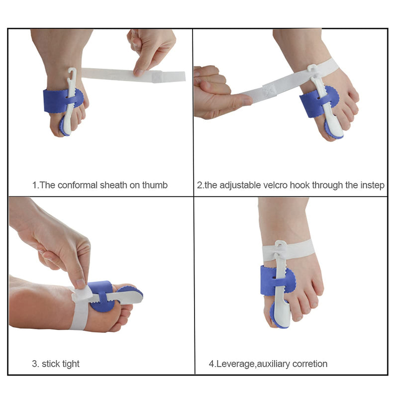 ANKROYU Hallux Valgus Corrector for Toes, Bunion Brace for Pain Relief, Adjustable Hallux Valgus Toe Separator, Hallux Valgus Splint for Men and Women - NewNest Australia