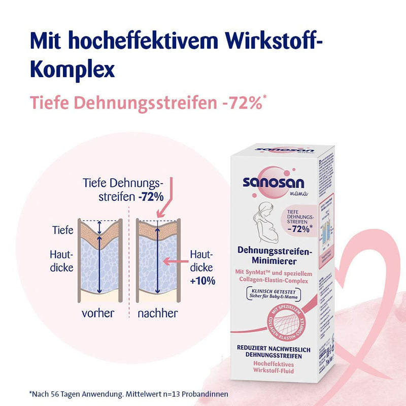 sanosan stretch mark minimizer clinically tested - proven to reduce stretch marks after pregnancy - stretch mark cream without paraffin oil, dyes, silicones (1x 75 ml) 1 piece - NewNest Australia