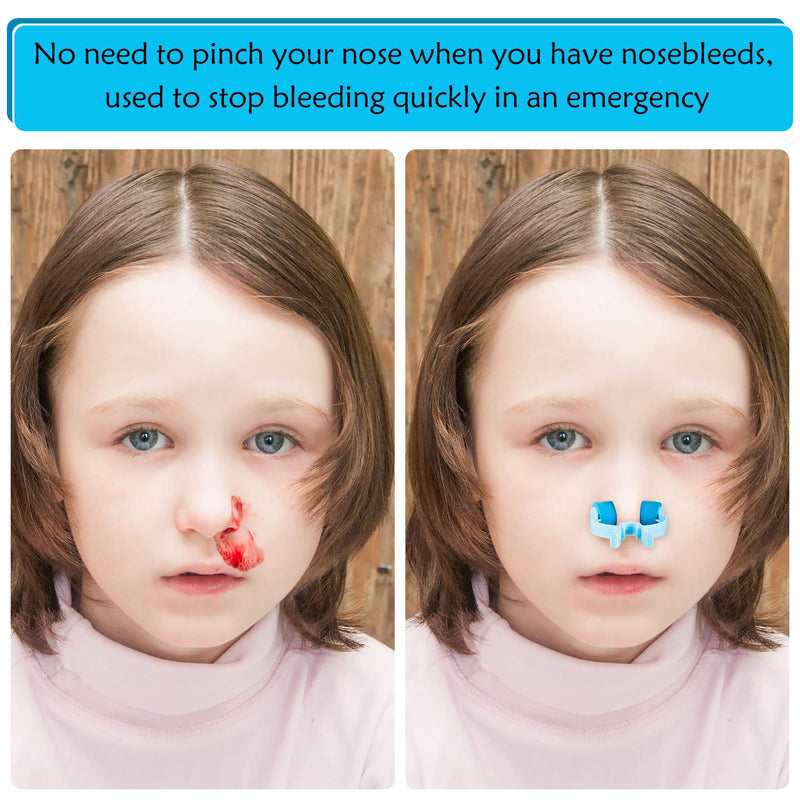 Nose Stop Clips Nasal Nose Stopper Clips Plastic Foam Nose Clips for Emergency or Accident (30) 30 - NewNest Australia