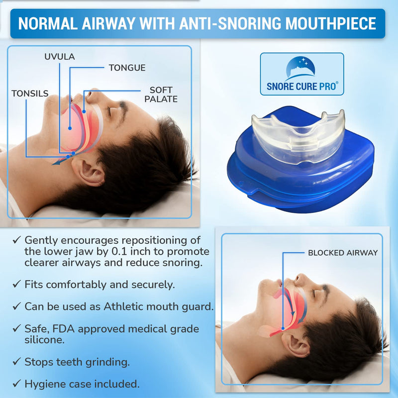 Anti Snore Devices Kit | 1 Mouth Guard | 10 Nasal Strips | 4 Nose Vents | 2 Nose Clips | Ear Plugs | Custom Stop Snoring Hypnosis Recording + Ebook | Premium Snoring aids for Men & Women - NewNest Australia
