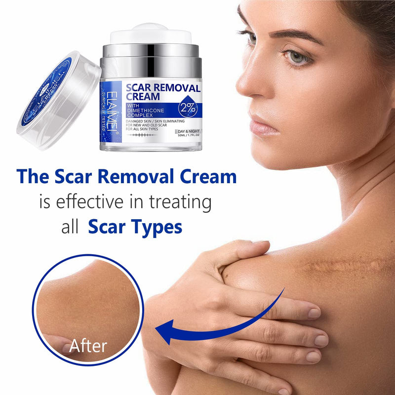 Scar Removal Cream, Skin Repair Cream for Old and New Scars, Scar Treatment Gel for Surgical Scars, Acne Scars, C-Section, Burns, Stretch Marks - NewNest Australia