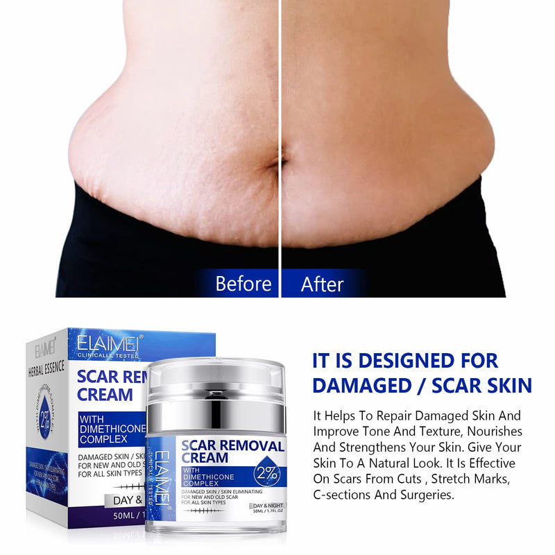 Scar Removal Cream,Rapid Repair of New and Old Scars,Soften and Flattens Scars Resulting from Surgery, Injury, Burns, C-Section et, Natural Scar Treatment for Women&Men - NewNest Australia