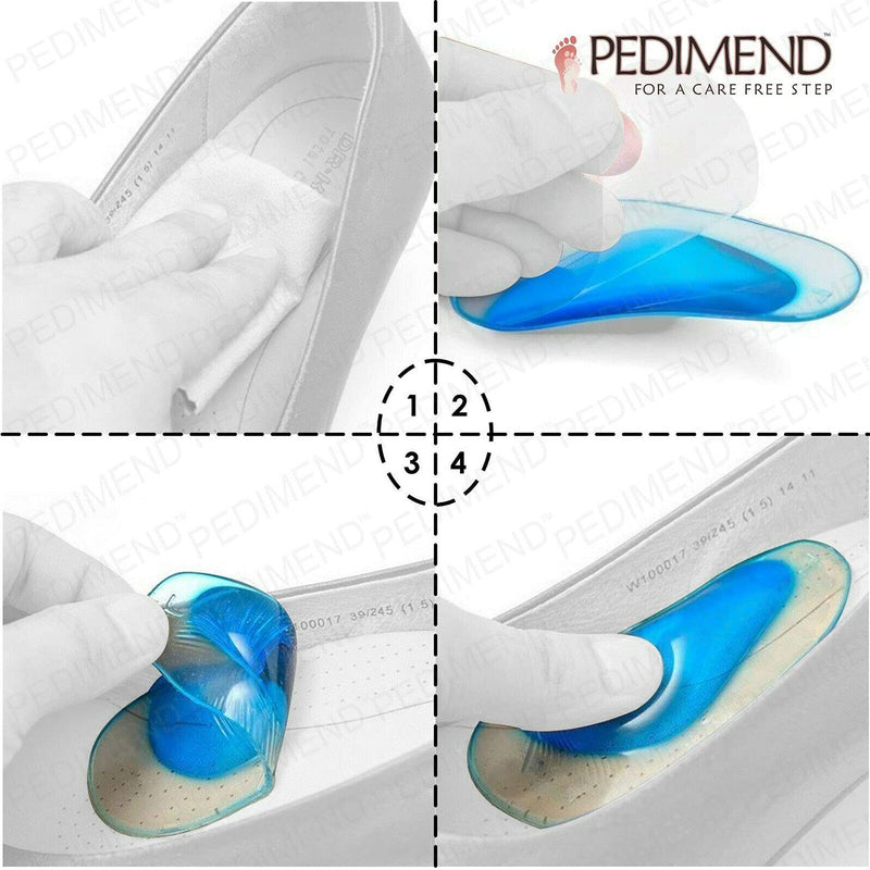 Pedimend Silicone Gel Flatfoot Inserts (2PAIR) - Plantar Fasciitis Arch Support - Relieve Painful Foot Conditions Like Plantar Fasciitis, Heel Spurs, Sprains and Strains – for Men & Women - Foot Care - NewNest Australia