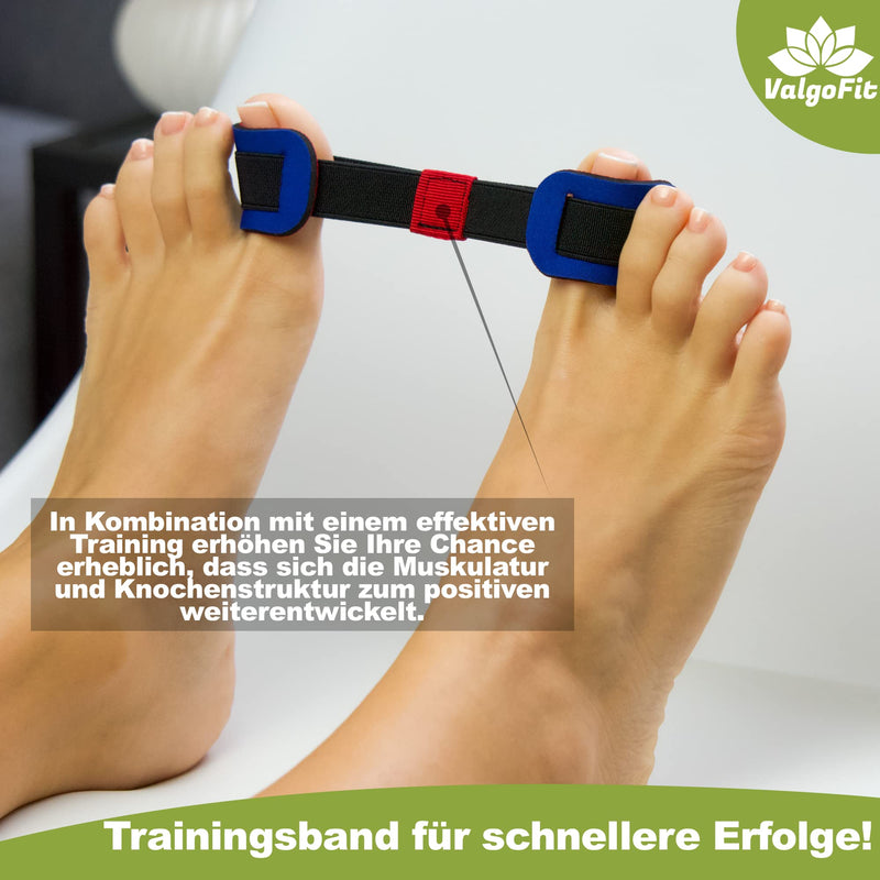ValgoFit® Hallux Valgus correction splint - DERMATEST: VERY GOOD - with 2x correction splints - 2x bunion socks - 2x silicone toe separators - 1x training band - NewNest Australia