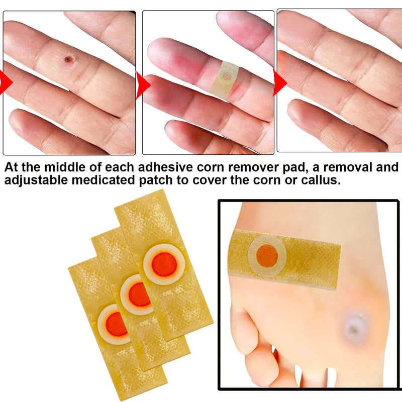 Mcvcoyh Corn Removal Pads, 42 Pcs Wart Remover, Corn Remover Pads, Corn Removal Plaster with Hole, Corn Removal Treatment Relief Corn Pain and Foot Care Nude - NewNest Australia